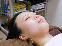 施術の様子2