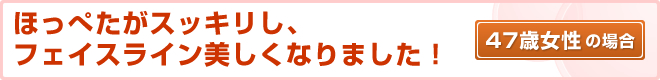 47歳女性の場合